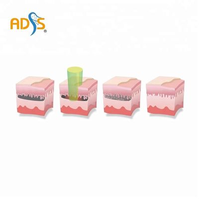 OEM / ODM Q Switch Yag Lazer Dövme Silme Makinesi 2 Yıl Garanti