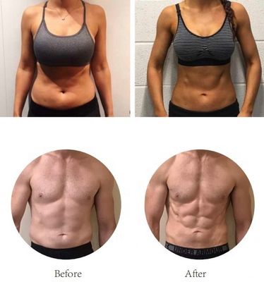 OEM EMS Fitness Makinesi heykel Ekipmanları, Selülit ve Yağ Azaltma Makinesi