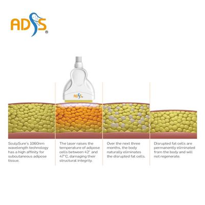 1060nm Cryolipolysis Zayıflama Makinesi 4 Kolları Diyot Lazer Zayıflama Makinesi
